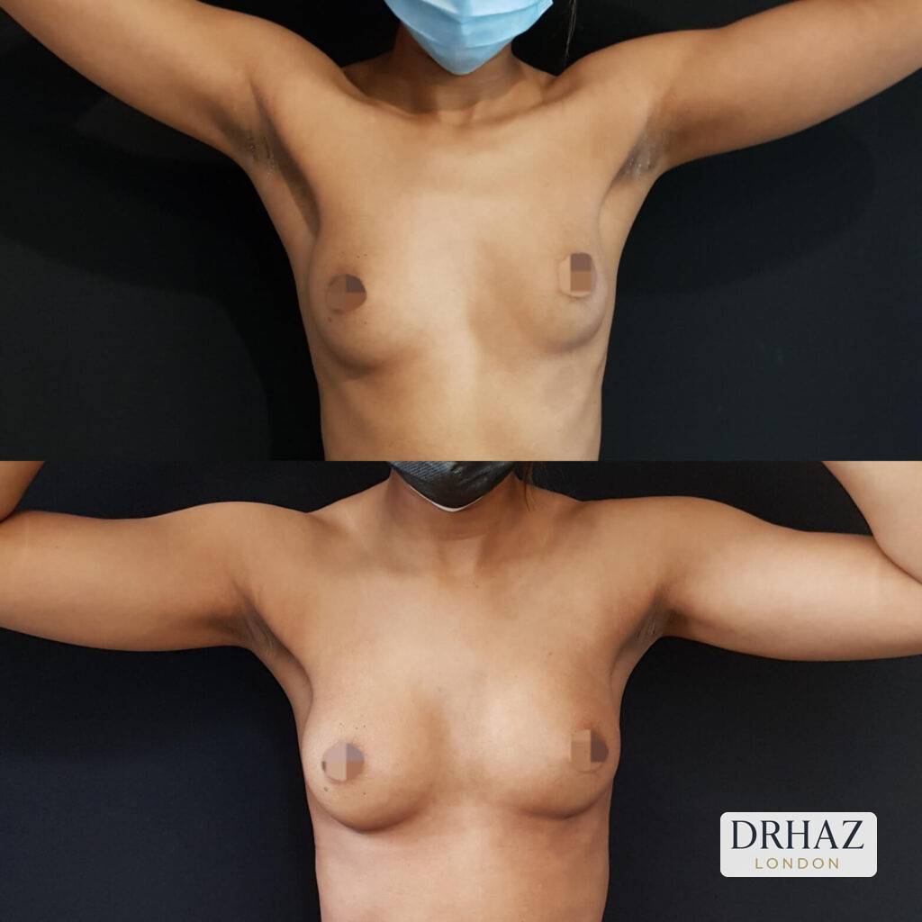 Patient 127