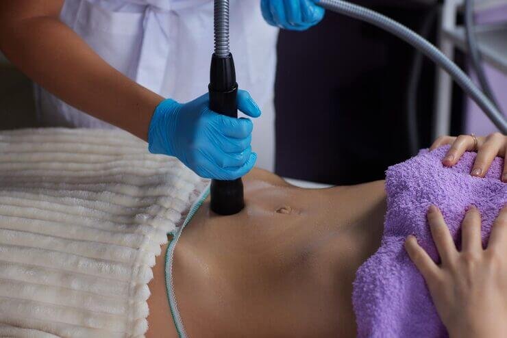 Body Contouring with Quantum RF